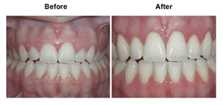 New Smile Dental Clinic Dental Services Oral Surgery Phuket Thailand